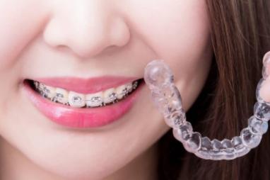 Orthodontic Services